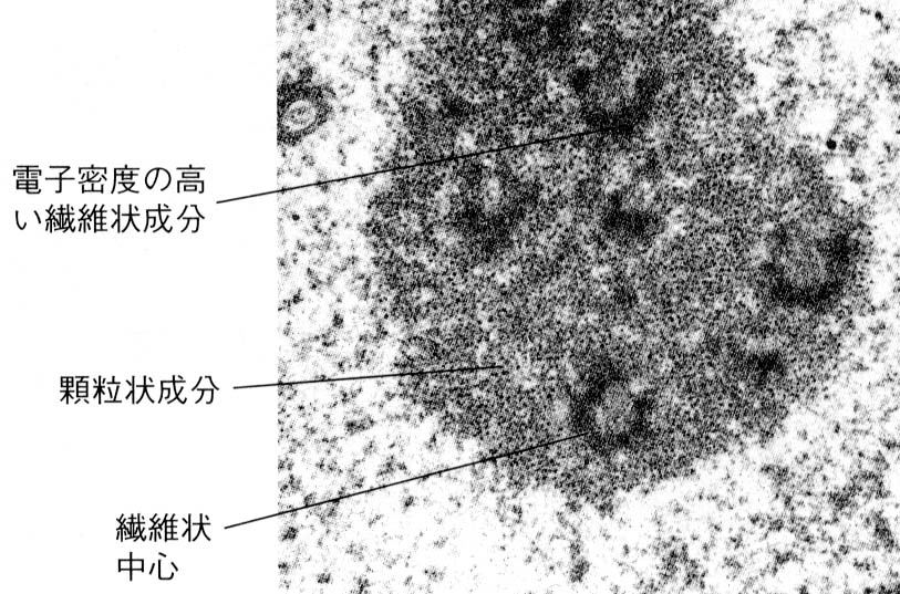 核小体の定義